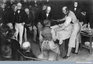 robert-liston