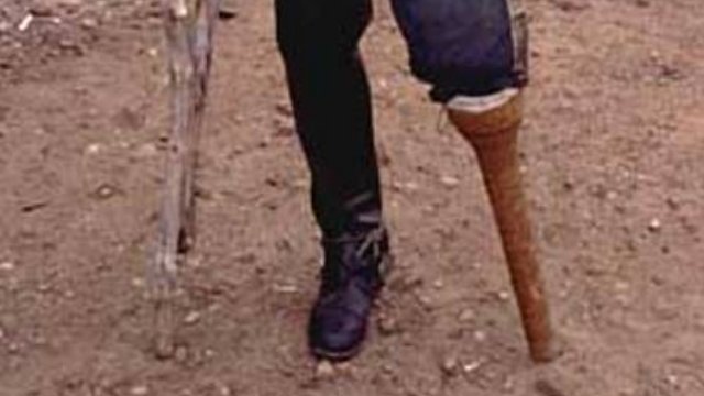 wooden_leg