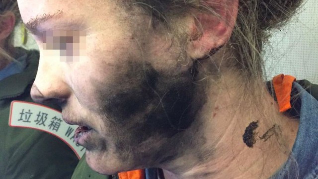exploding headphones